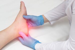 Espolon calcaneo y fascitis plantar 2