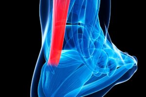 Tendinitis en el pie