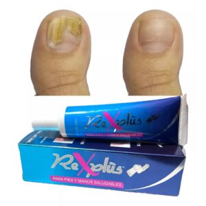 Crema Rexplus Para Eliminar Hongos En Uñas 35ml Pies Y Manos